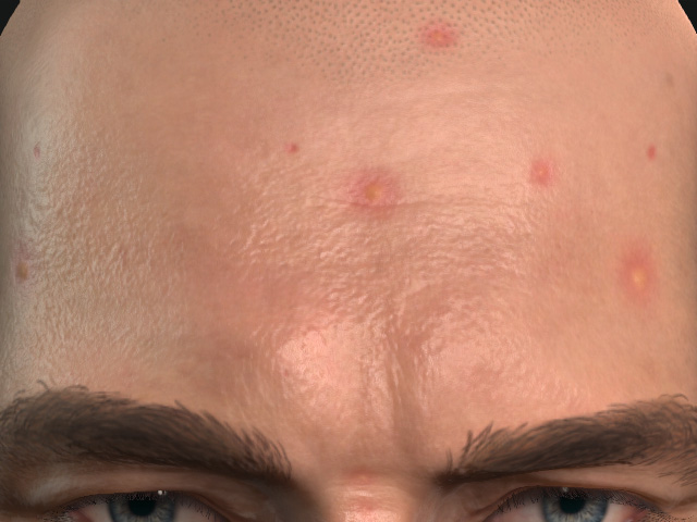 Settings in Appearance Editor - Acne