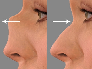 鼻の輪郭と鼻孔の形状のセッティング